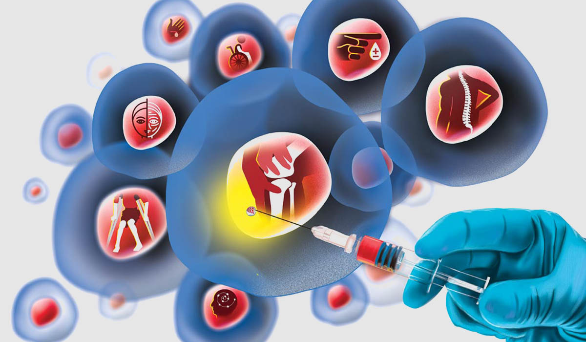 Stem Cell Therapy in Ahmedabad