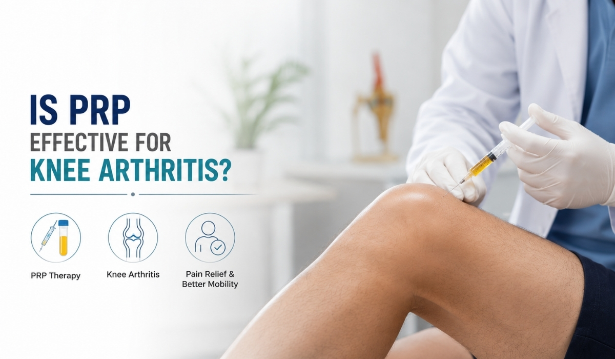 Prp theraphy for Knee Arthritis