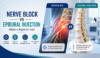 Comparison of nerve block and epidural injection procedures for pain management