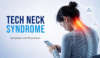 tech neck syndrome