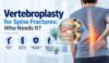 Vertebroplasty for spine fractures showing bone cement injection into a fractured vertebra