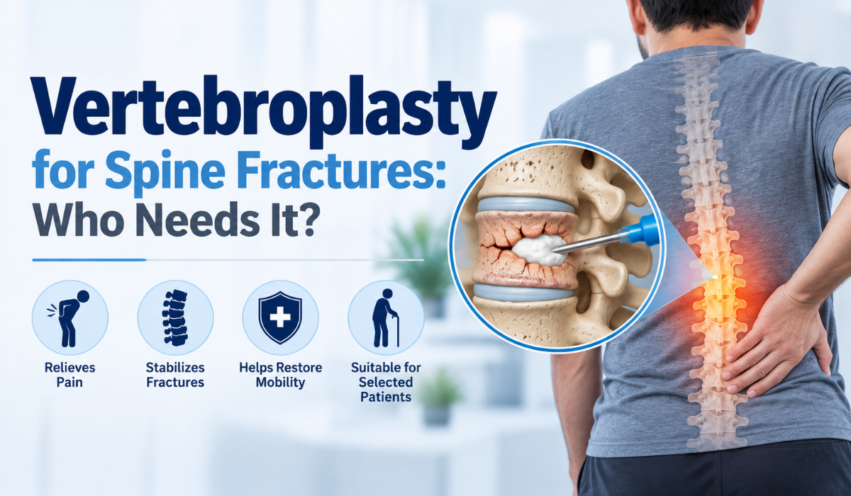 Vertebroplasty for spine fractures showing bone cement injection into a fractured vertebra