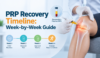 PRP recovery timeline showing the expected stages of recovery after platelet-rich plasma injection