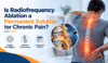 Radiofrequency ablation for chronic pain showing a targeted nerve treatment using a radiofrequency probe