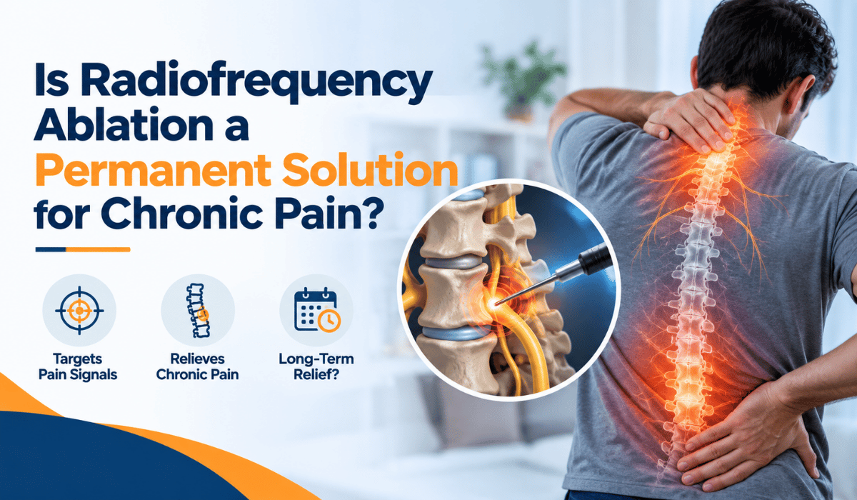 Radiofrequency ablation for chronic pain showing a targeted nerve treatment using a radiofrequency probe