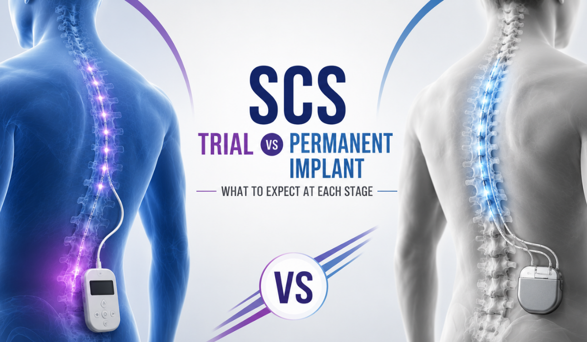 Scs trail vs permanent