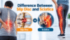 Difference between slip disc and sciatica showing a herniated disc and sciatic nerve pain symptoms